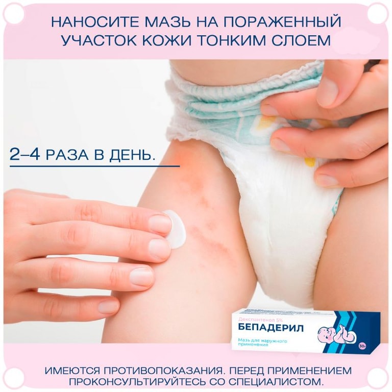 Бепадерил 5% мазь для наружного применения 30 г