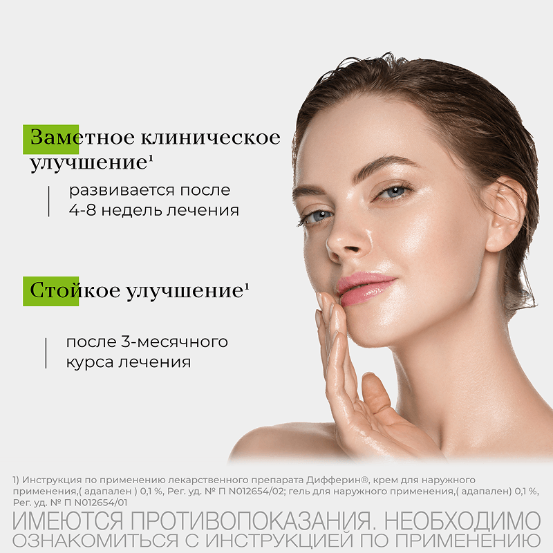 Дифферин 0,1% крем от акне, угрей и черных точек 30 г