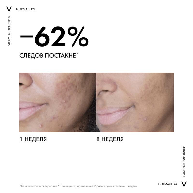 Vichy Normaderm Крем-уход корректирующий двойного действия для проблемной кожи склонной к жирности 50 мл
