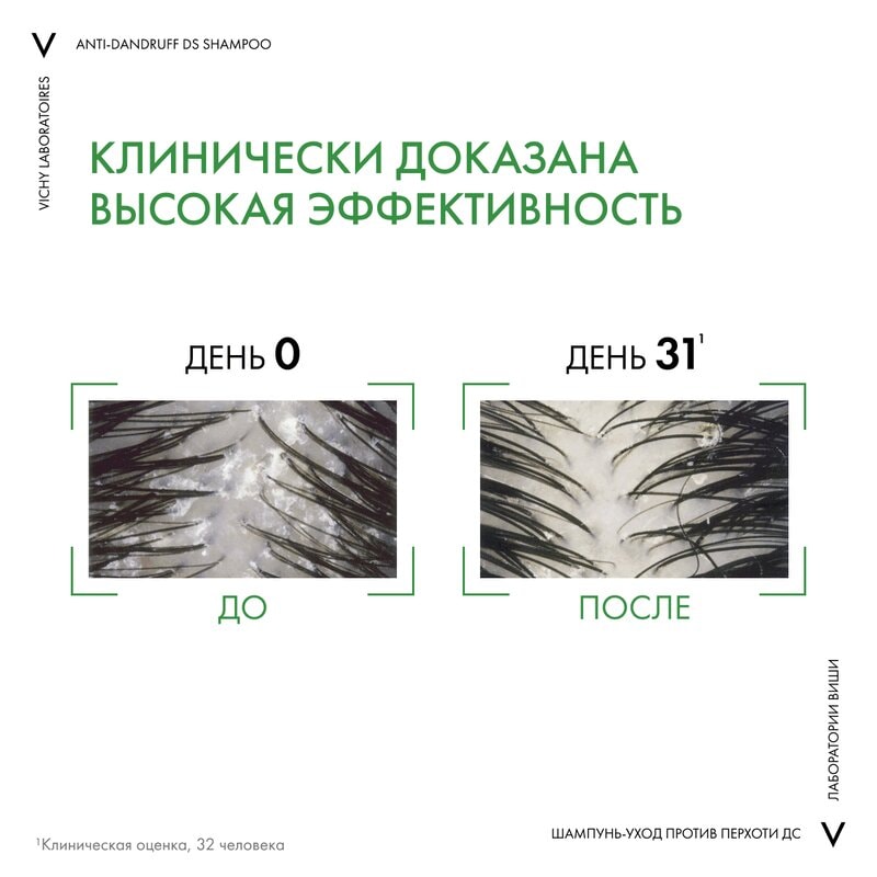 Vichy Dercos Шампунь-уход интенсивный против перхоти для нормальных и жирных волос 50 мл