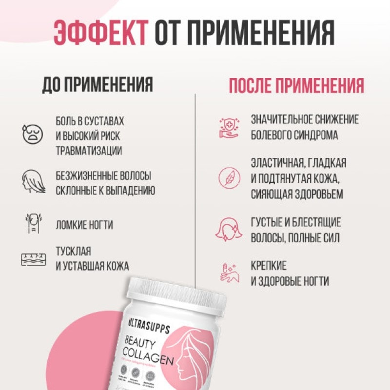 Ultrasupps Бьюти Коллаген пептиды порошок 150 г