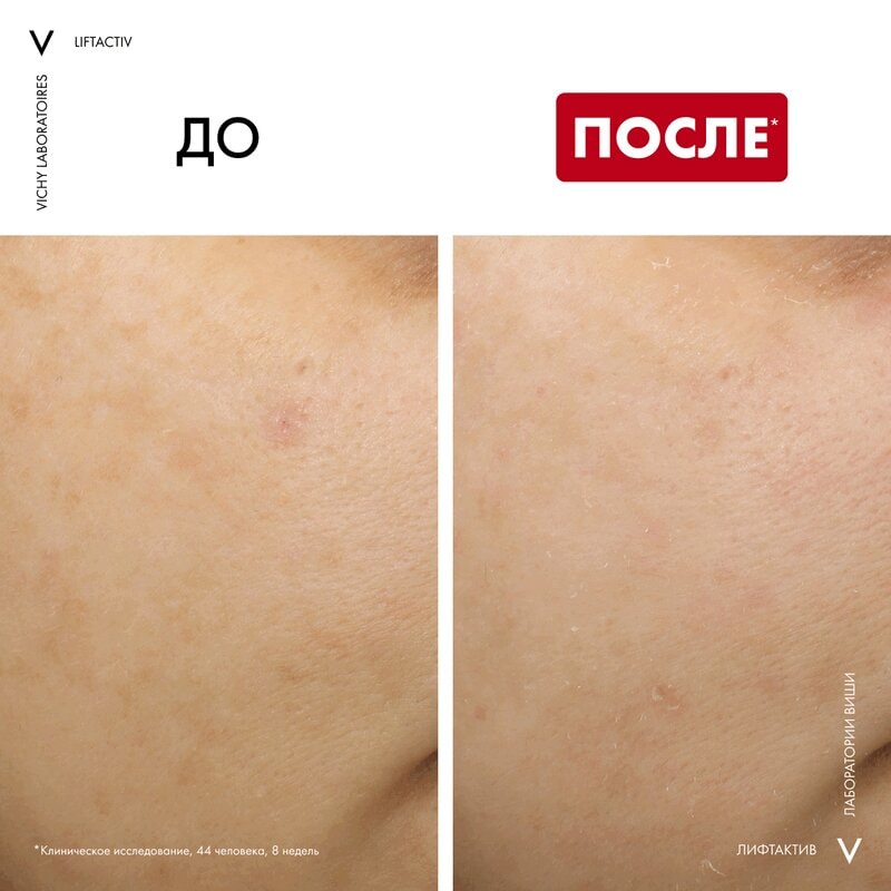 Vichy Liftactiv Крем ночной для лица с ретинолом против пигментации и морщин 50 мл