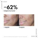 Vichy Normaderm Крем-уход корректирующий двойного действия для проблемной кожи склонной к жирности 50 мл