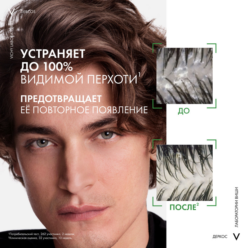 Vichy Dercos DS Шампунь-уход интенсивный увлажняющий против перхоти 2в1 200 мл
